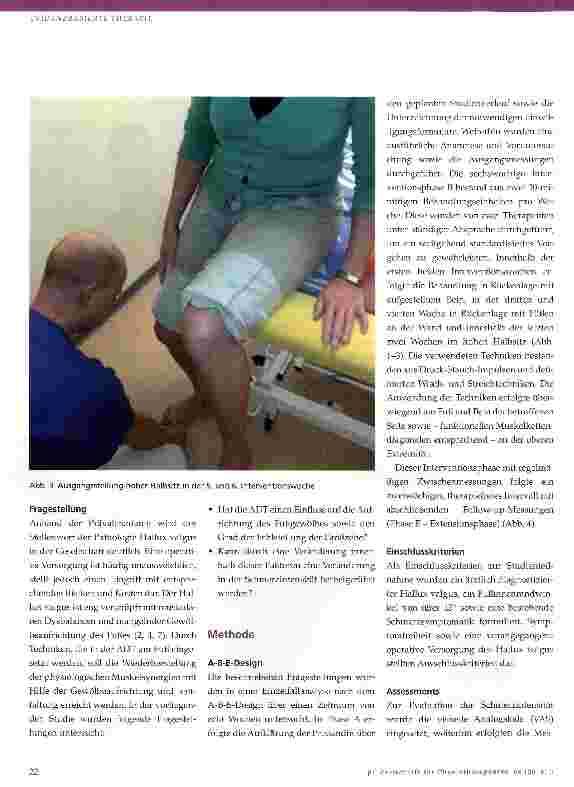 Vorschauseite 4: Akrodynamische Therapie verbessert die Navikularhöhe und mindert den Fußinnenrandwinkel bei Hallux valgus