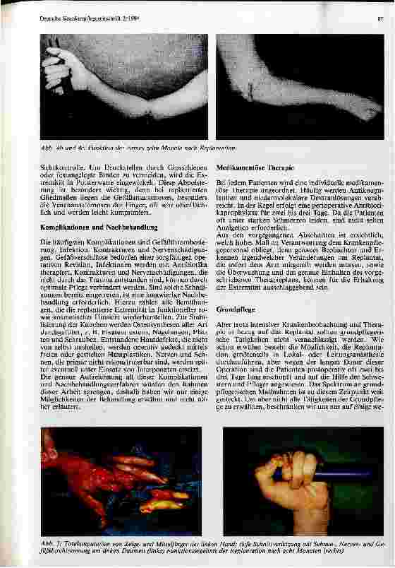 Vorschauseite 3: Therapie und Pflege mikrochirurgisch versorgter Patienten nach traumatischer Amputation und Replantation