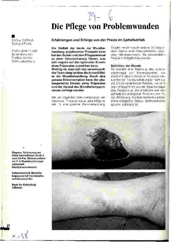 Vorschauseite 1: Die Pflege von Problemwunden Erfahrungen und Erfolge aus der Praxis im Spitalbetrieb
