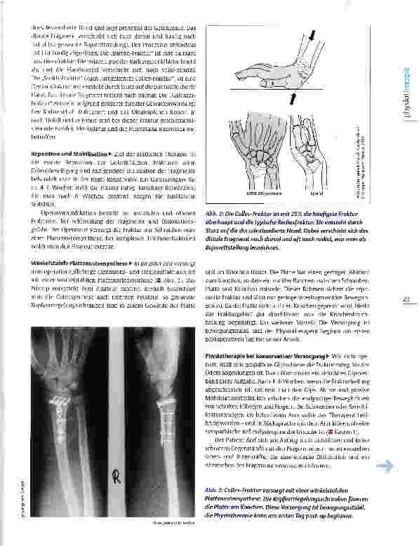 Vorschauseite 2: Rehabilitation nach distaler Radiusfraktur Therapie von Colles & Co