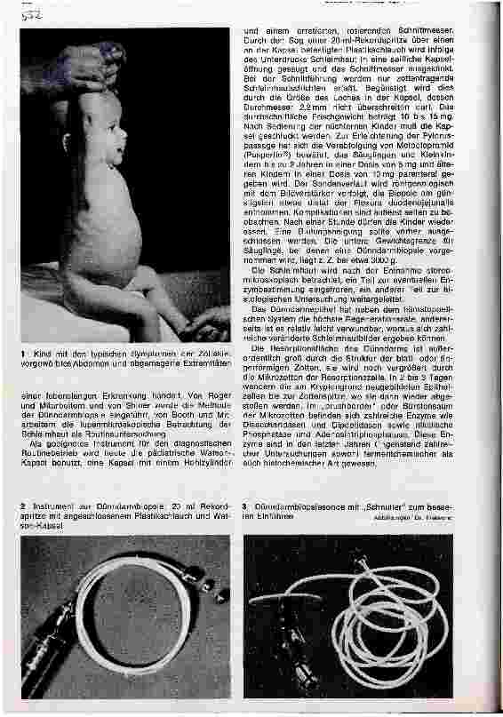 Vorschauseite 2: Chronische Verdauungsinsuffizienz im Kindesalter