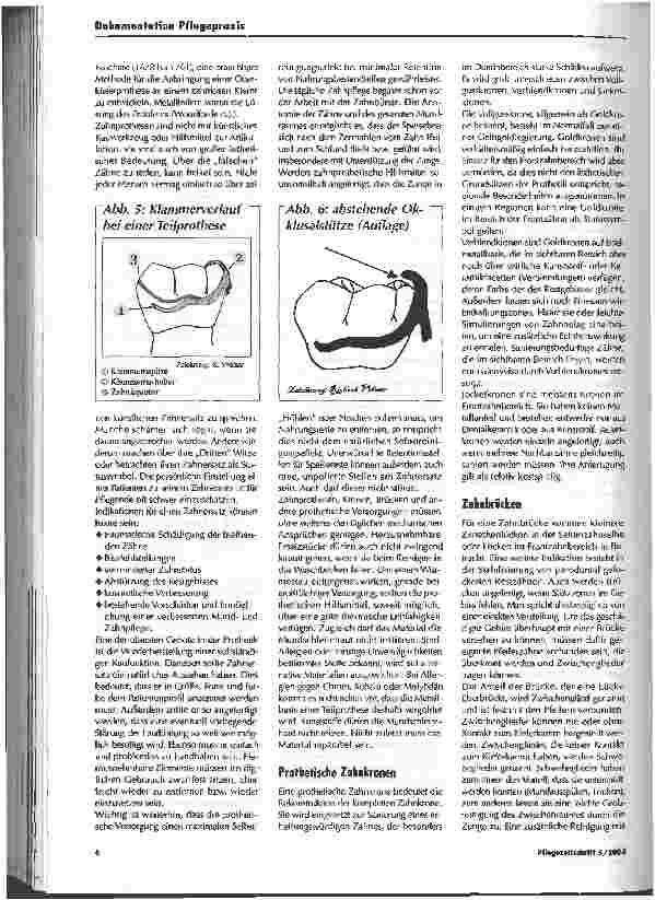 Vorschauseite 5: Nützliche und wichtige Aspekte der Zahlpflege und des Umgangs mit zahnprothetischen Versorgungen
