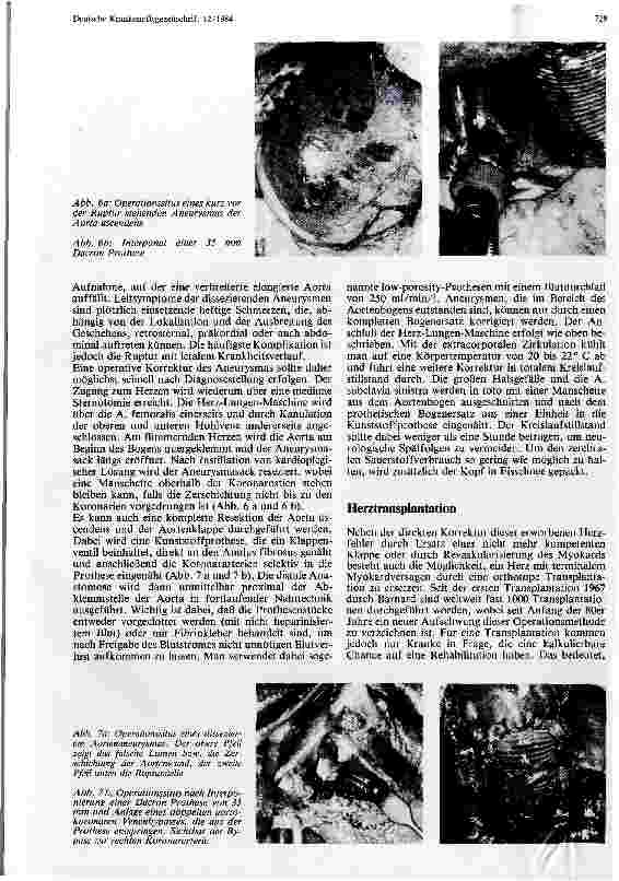 Vorschauseite 4: Möglichkeiten der Herzchirurgie heute