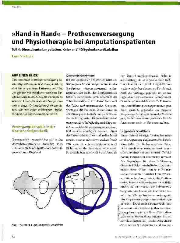 Vorschauseite 1: »Hand in Hand« - Prothesenversorgung und Physiotherapie bei AmputationspatientenTeil 4: Oberschenkelamputation, Knieund Hüftgelenkexartikulation