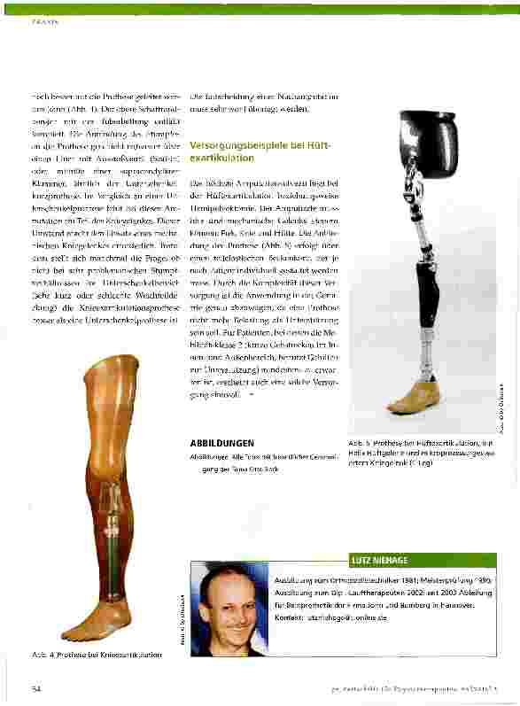 Vorschauseite 3: »Hand in Hand« - Prothesenversorgung und Physiotherapie bei AmputationspatientenTeil 4: Oberschenkelamputation, Knieund Hüftgelenkexartikulation