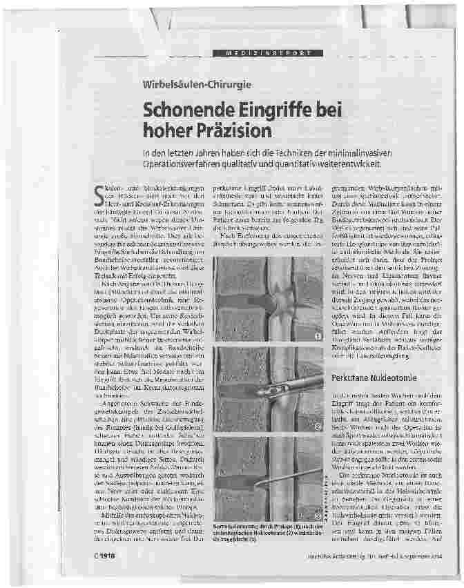 Vorschauseite 1: Schonende Eingriffe bei hoher. Präzision Wirbelsäulen-Chirurgie