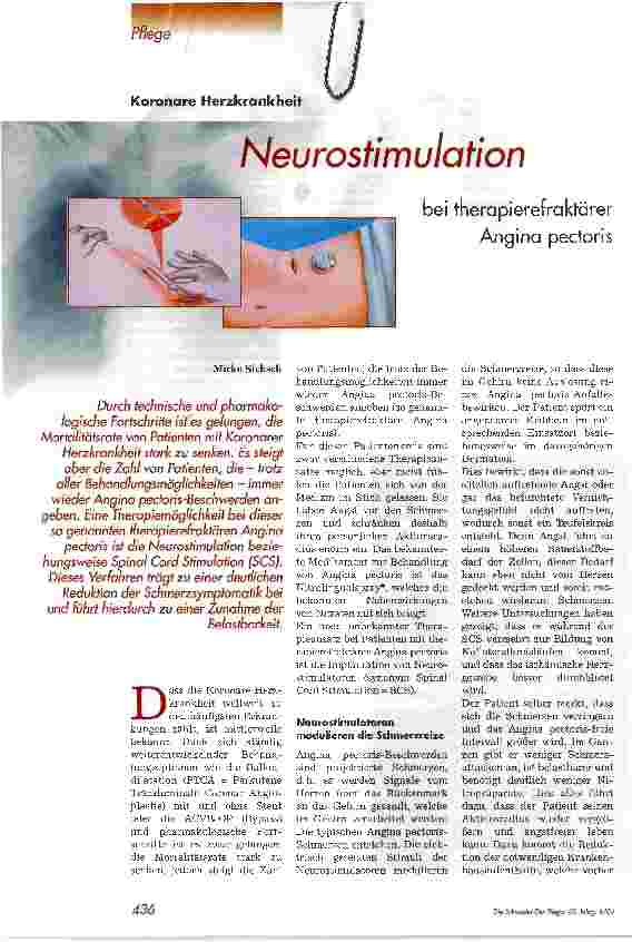 Vorschauseite 1: Neurostimulotion bei therapierefraktärer Angina pectoris