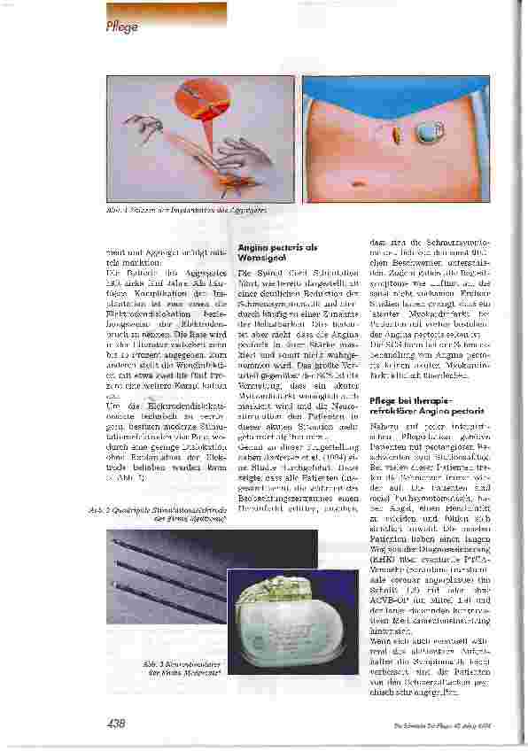 Vorschauseite 3: Neurostimulotion bei therapierefraktärer Angina pectoris