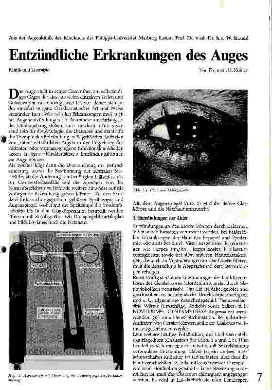 Vorschauseite 1: Entzündliche Erkrankungen des Auges Klinik und Therapie
