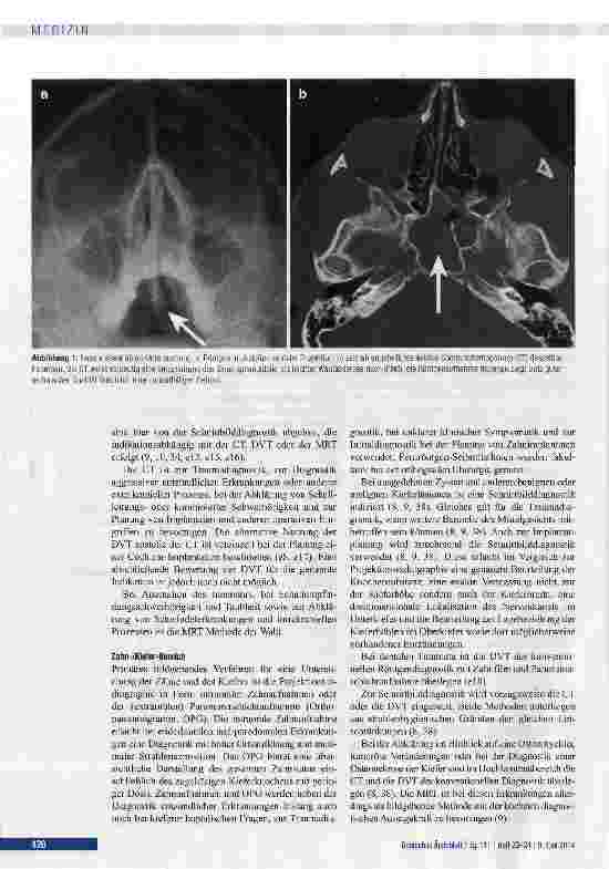 Vorschauseite 4: Bildgebende Verfahren in der Kopf-Hals-Diagnostik