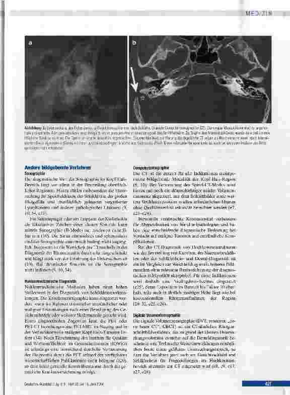 Vorschauseite 5: Bildgebende Verfahren in der Kopf-Hals-Diagnostik
