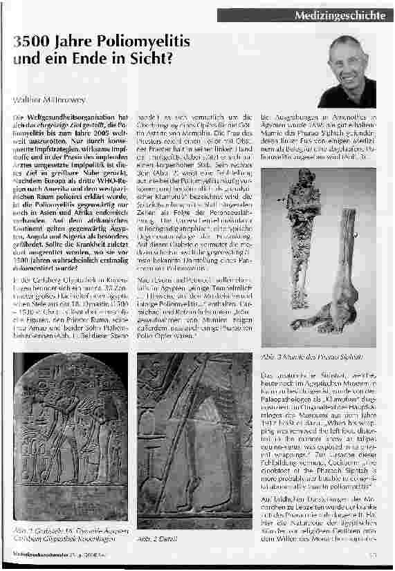 Vorschauseite 1: 3500 Jahre Poliomyelitis und ein Ende in Sicht?