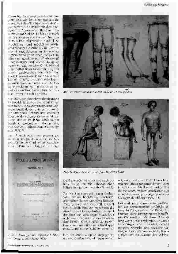 Vorschauseite 3: 3500 Jahre Poliomyelitis und ein Ende in Sicht?