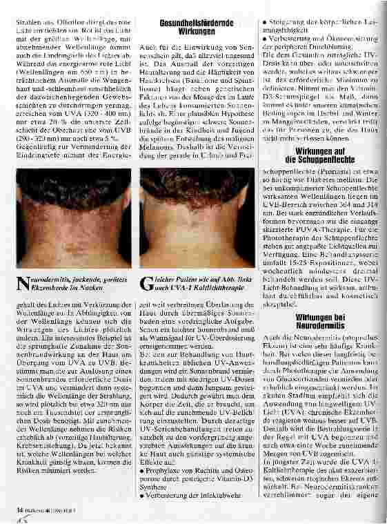 Vorschauseite 2: UV-Licht als Therapeutikum Renaissance der Phototherapie