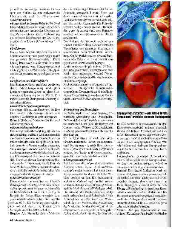 Vorschauseite 2: Thromboseprophylaxe Möglichkeiten der Pflege