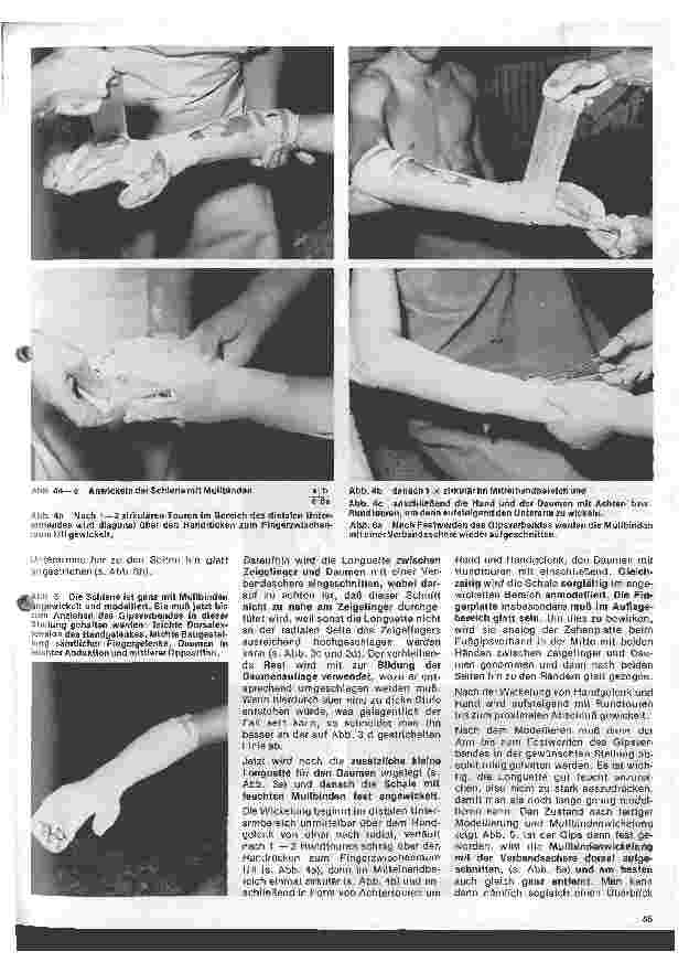 Vorschauseite 3: Grundlagen und Technik des Gipsverbandes 42. Folge: Schalenverbände am Arm
