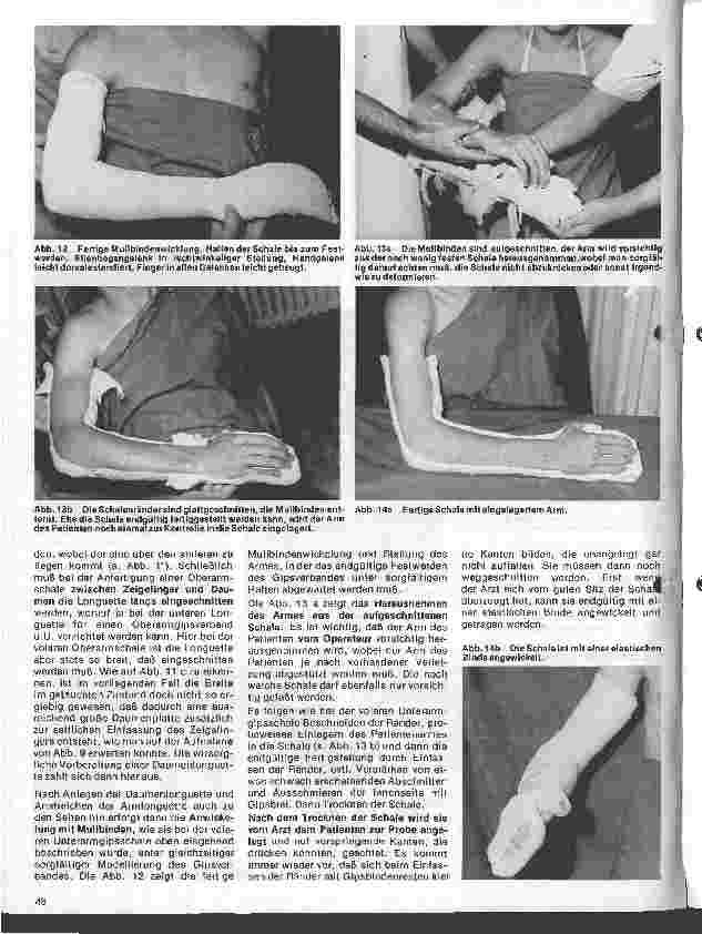 Vorschauseite 6: Grundlagen und Technik des Gipsverbandes 42. Folge: Schalenverbände am Arm