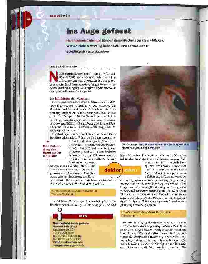 Vorschauseite 1: Ins Auge gefasst