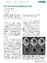 Vorschauseite 1: Das Foix-Chavany-Marie-Syndrom