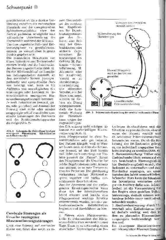 Vorschauseite 2: Blasenentleerungstechniken bei neurogener Blasendysfunktion