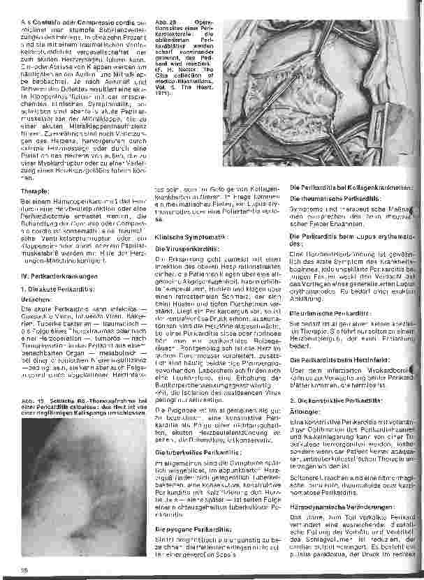 Vorschauseite 5: Das Herz 13.Folge: Erworbene Herzfehler, Klinik und operative Therapie (3.Teil)