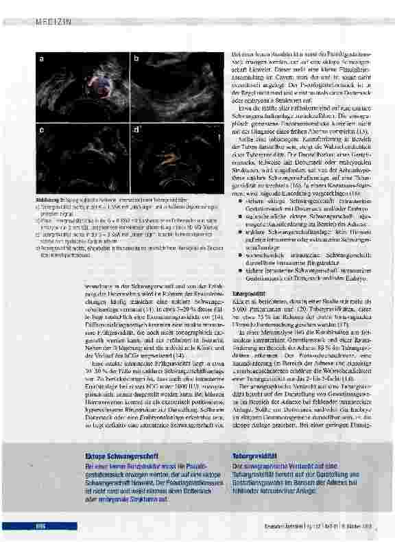 Vorschauseite 4: Diagnostik und Therapiestrategien bei Extrautenngravidität