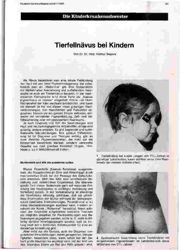 Vorschauseite 1: Tierfellnävus bei Kindern