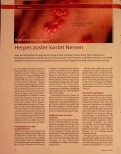 Vorschauseite 1: Herpes zoster kostet Nerven.