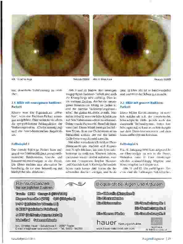 Vorschauseite 2: Die biliäre und die hämatogene Konstitution Konstitutionen in der Augendiagnose Teil 2