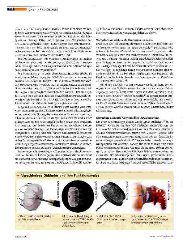 Vorschauseite 2: Vorhofohr-Okkluder als Alternative zur Antikoagulation