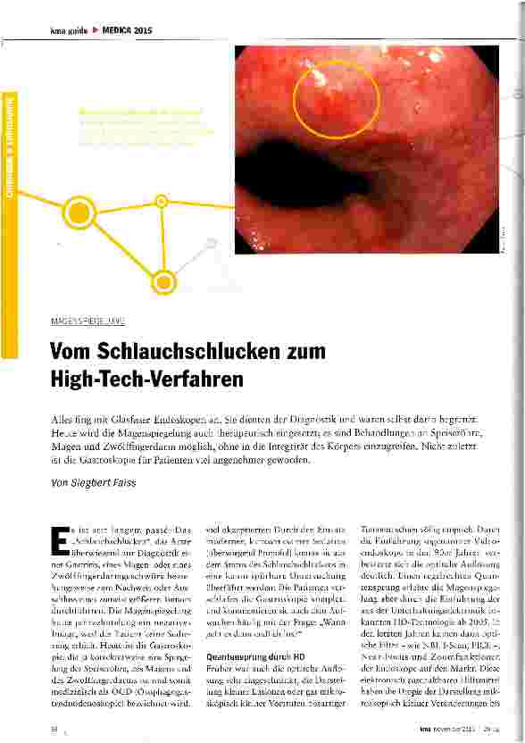 Vorschauseite 1: Vom Schlauchschlucken zum High-Tech-Verfahren