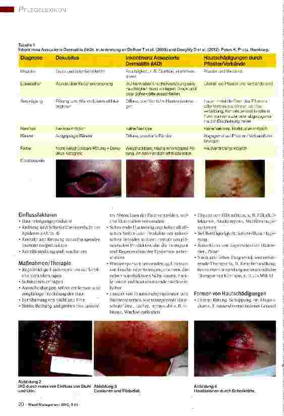 Vorschauseite 2: PFLEGELEXIKON -DIESERIE ZUM SAMMELN Inkontinenz Assoziierte Dermatitis (IAD)