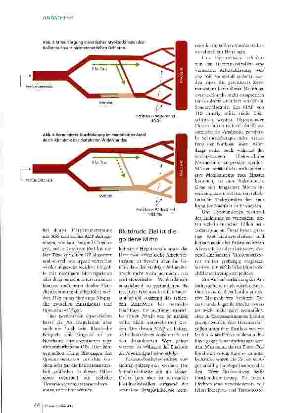 Vorschauseite 3: Risiko Koronarstents