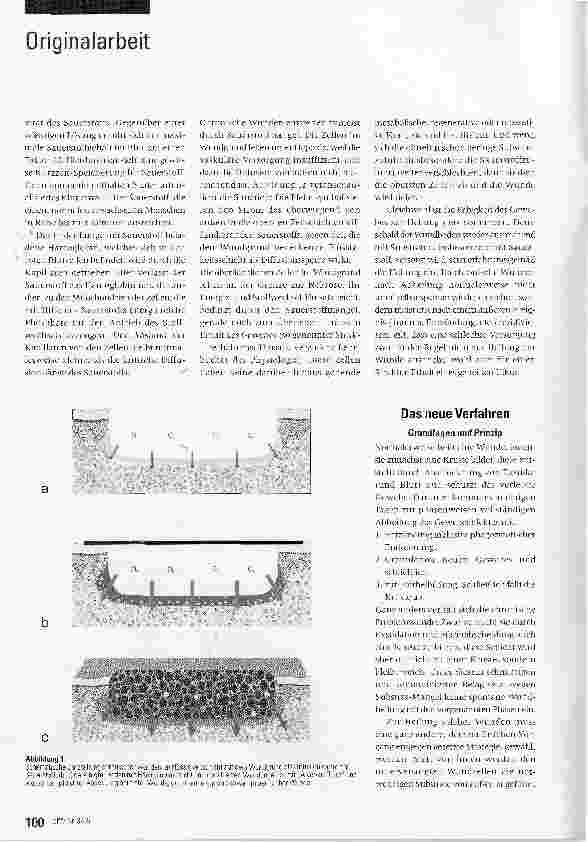 Vorschauseite 3: Eine neue topische Behandlung chronischer Wunden mit Hämoglobin und Sauerstoff: Verfahren und erste Ergebnisse*