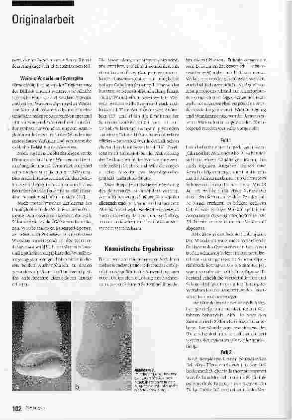 Vorschauseite 5: Eine neue topische Behandlung chronischer Wunden mit Hämoglobin und Sauerstoff: Verfahren und erste Ergebnisse*