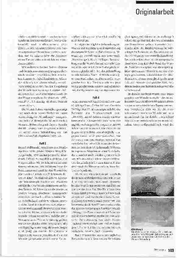 Vorschauseite 6: Eine neue topische Behandlung chronischer Wunden mit Hämoglobin und Sauerstoff: Verfahren und erste Ergebnisse*