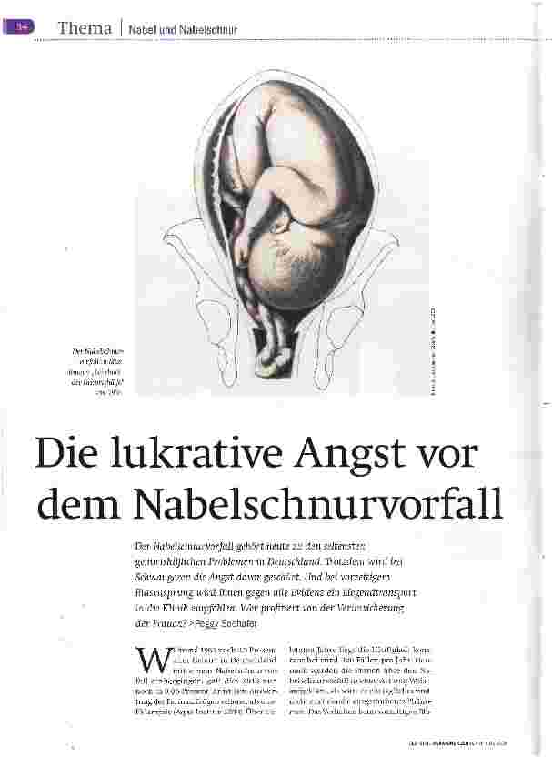 Vorschauseite 1: Die lukrative Angst vor dem Nabelschnurvorfall