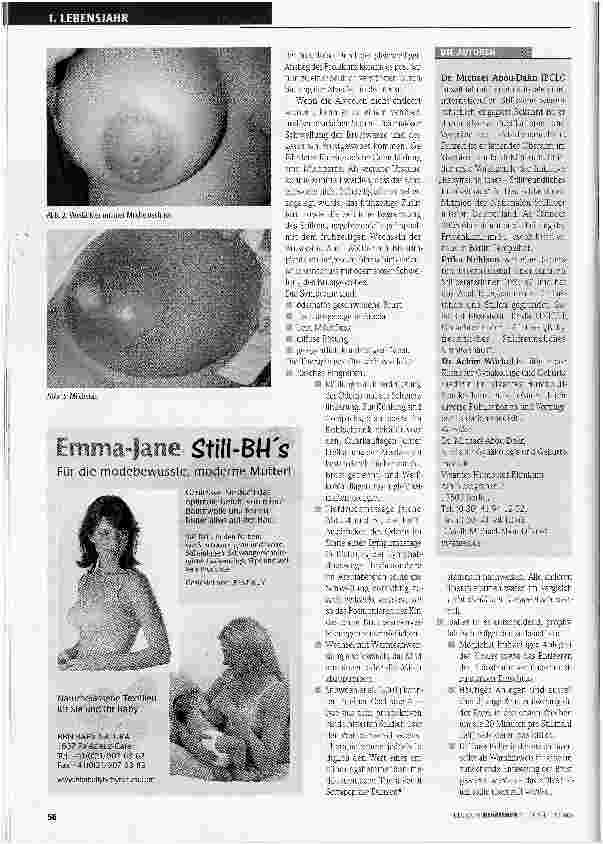 Vorschauseite 2: Nicht abstillen bei Mastitis oder Milchstau Teil I