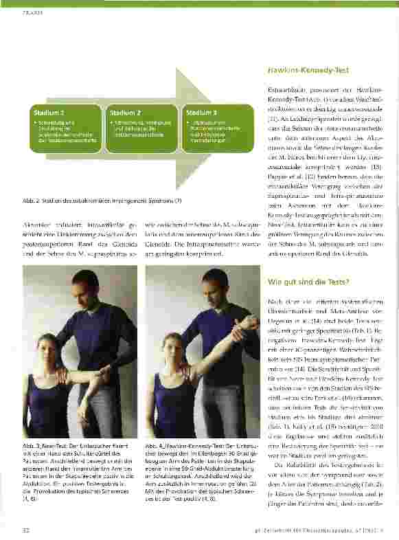 Vorschauseite 2: Subakromiales Impingement-Syndrom