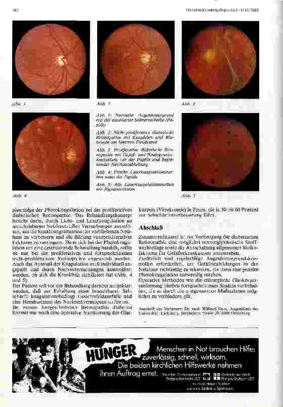 Vorschauseite 2: Diabetische Retinopathie