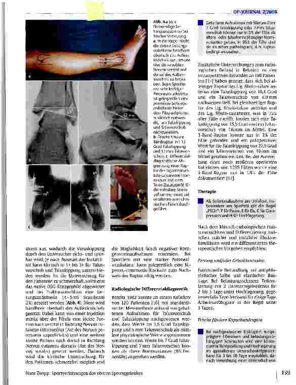 Vorschauseite 4: Sportverletzungen des oberen Sprunggelenkes