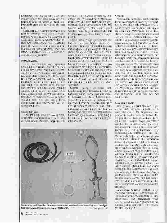 Vorschauseite 3: Gefährdetes Bonding. Auswirkungen von Interventionen
