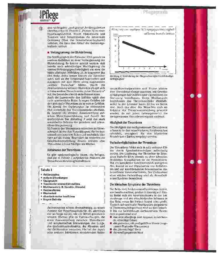 Vorschauseite 2: Zur Entstehung einer Thrombose