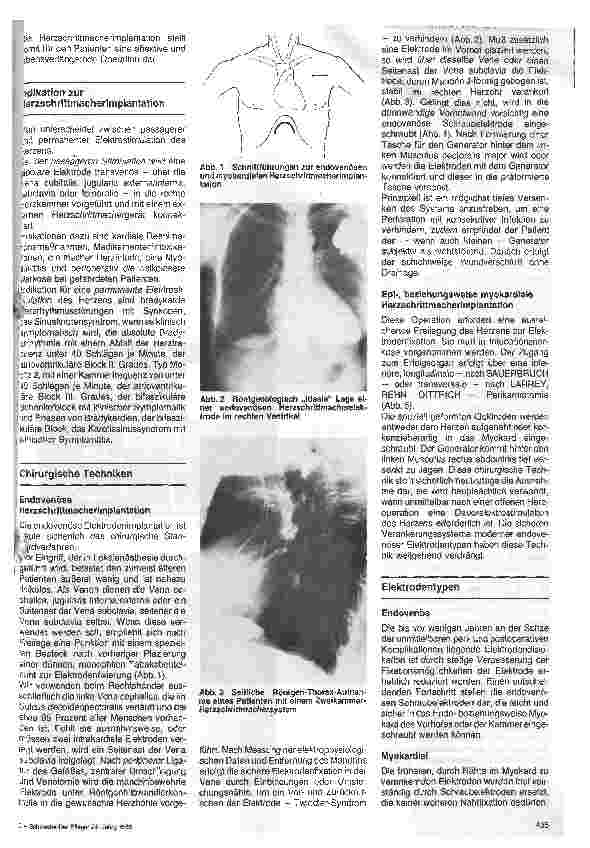Vorschauseite 2: Herzschrittmacherimplantation