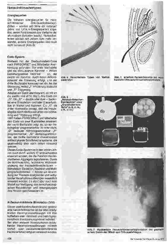 Vorschauseite 3: Herzschrittmacherimplantation