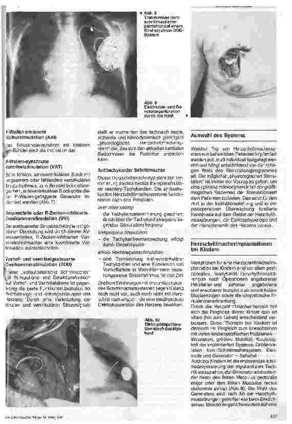 Vorschauseite 4: Herzschrittmacherimplantation