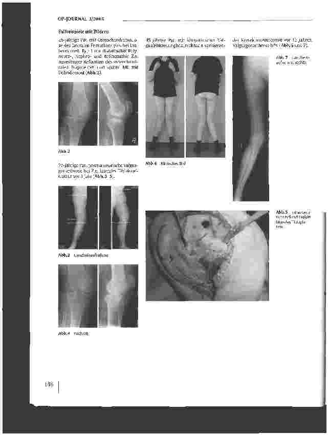Vorschauseite 5: Epidemiologie und Diagnostik der Gonarthrose
