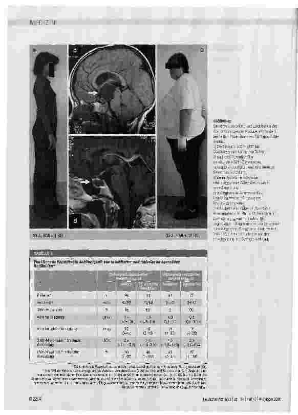 Vorschauseite 4: Kraniopharyngeom - im Kindesund Jugendalter