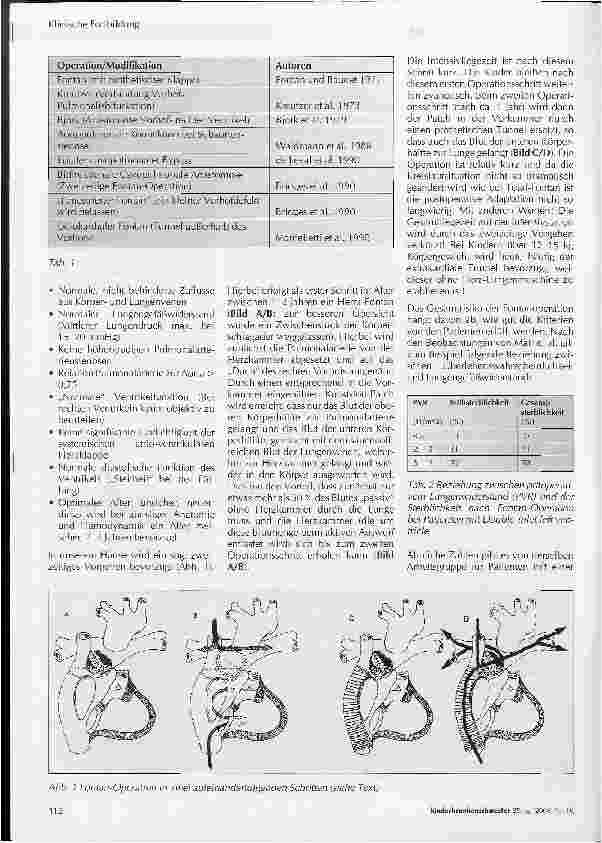 Vorschauseite 3: Die Fontan-Operation