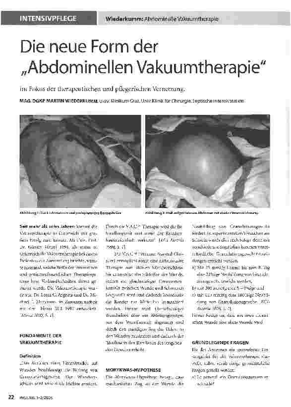 Vorschauseite 1: Die neue Form der Abdominellen Vakuumtherapieim Fokus der therapeutischen und pflegerischen Vernetzung.